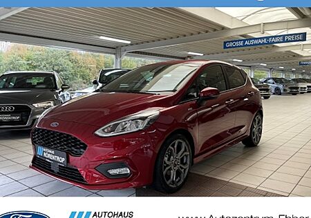 Ford Fiesta 1,0 EcoBoost 74kW S/S ST-Line 5 Türen