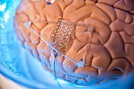 MenschMaschine-Visionen: Technik, die unter die Haut geht
