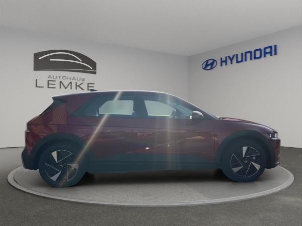 Hyundai IONIQ 5 ⚡️63kWh⚡️125kW/170PS INCL. WÄRMEPUMPE 🚗 SOFORT